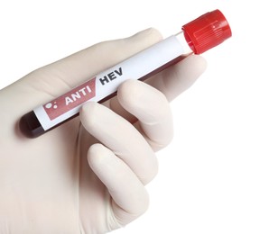 Photo of Scientist holding tube with blood sample and label Anti HEV on white background, closeup