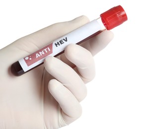 Scientist holding tube with blood sample and label Anti HEV on white background, closeup