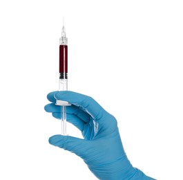 Photo of Nurse holding syringe with blood on white background, closeup