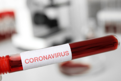 Photo of Test tube with blood sample and label CORONA VIRUS in laboratory, closeup