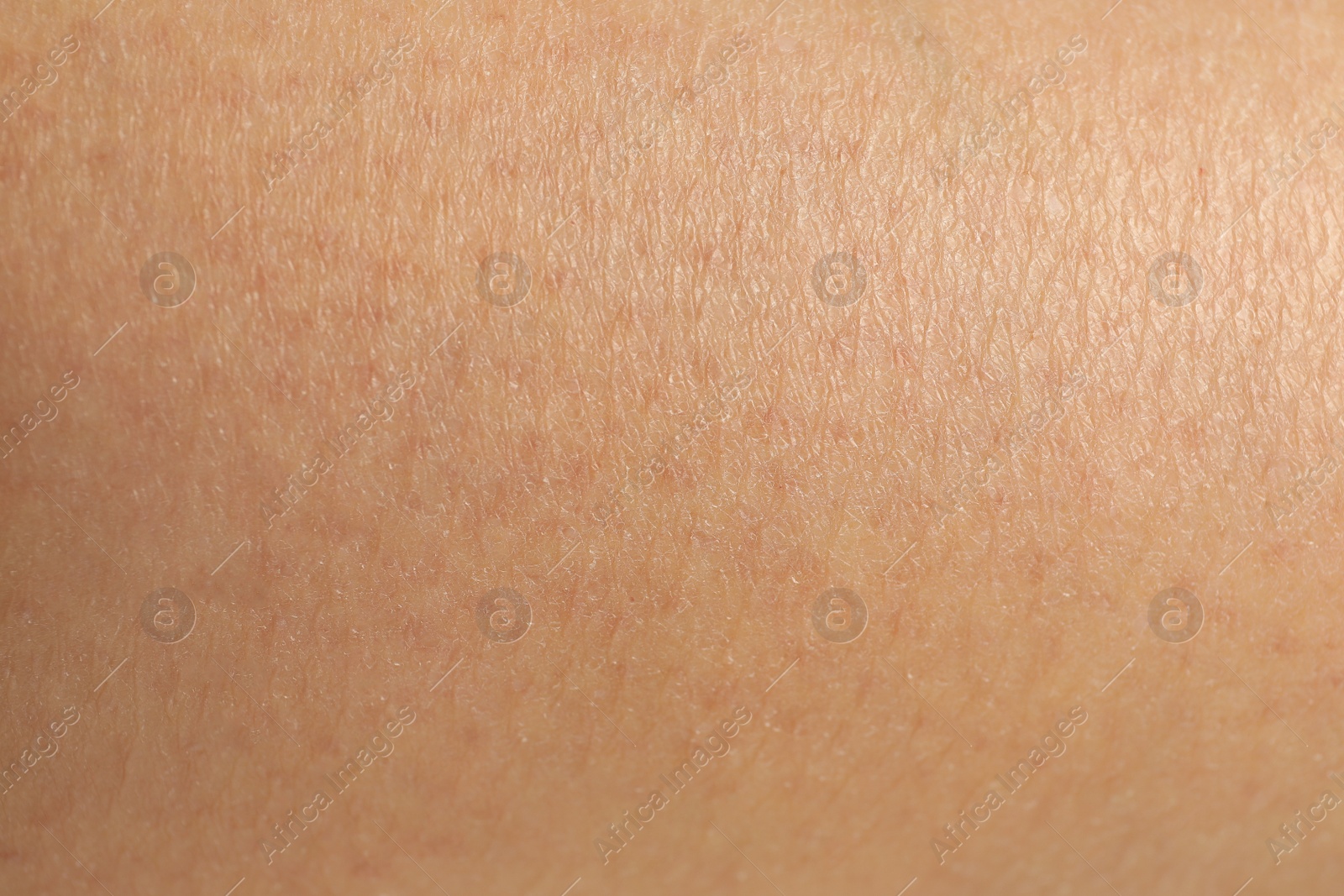 Photo of Texture of clean human skin, closeup view