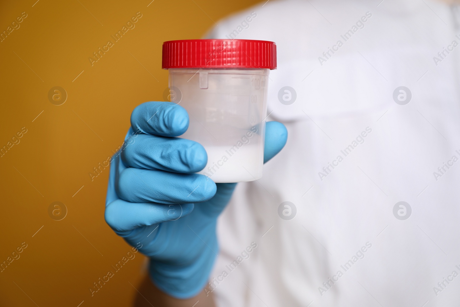 Photo of Scientist holding container with sperm on yellow background, closeup