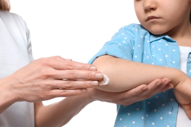Mother applying ointment on her daughter's elbow against white background, closeup
