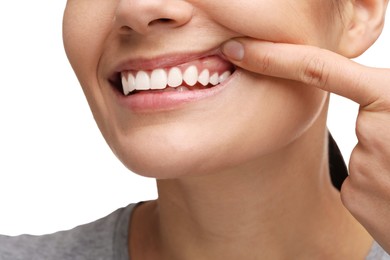 Woman showing her clean teeth on white background, closeup