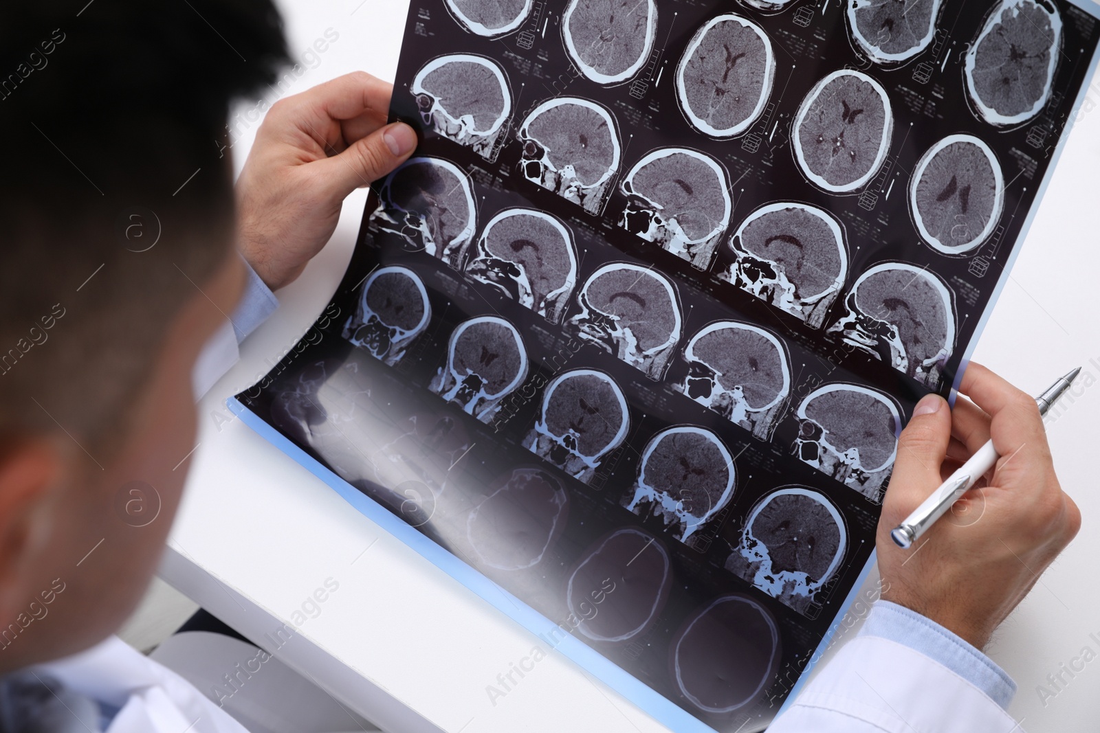 Photo of Doctor examining MRI images of patient with multiple sclerosis at white table, closeup