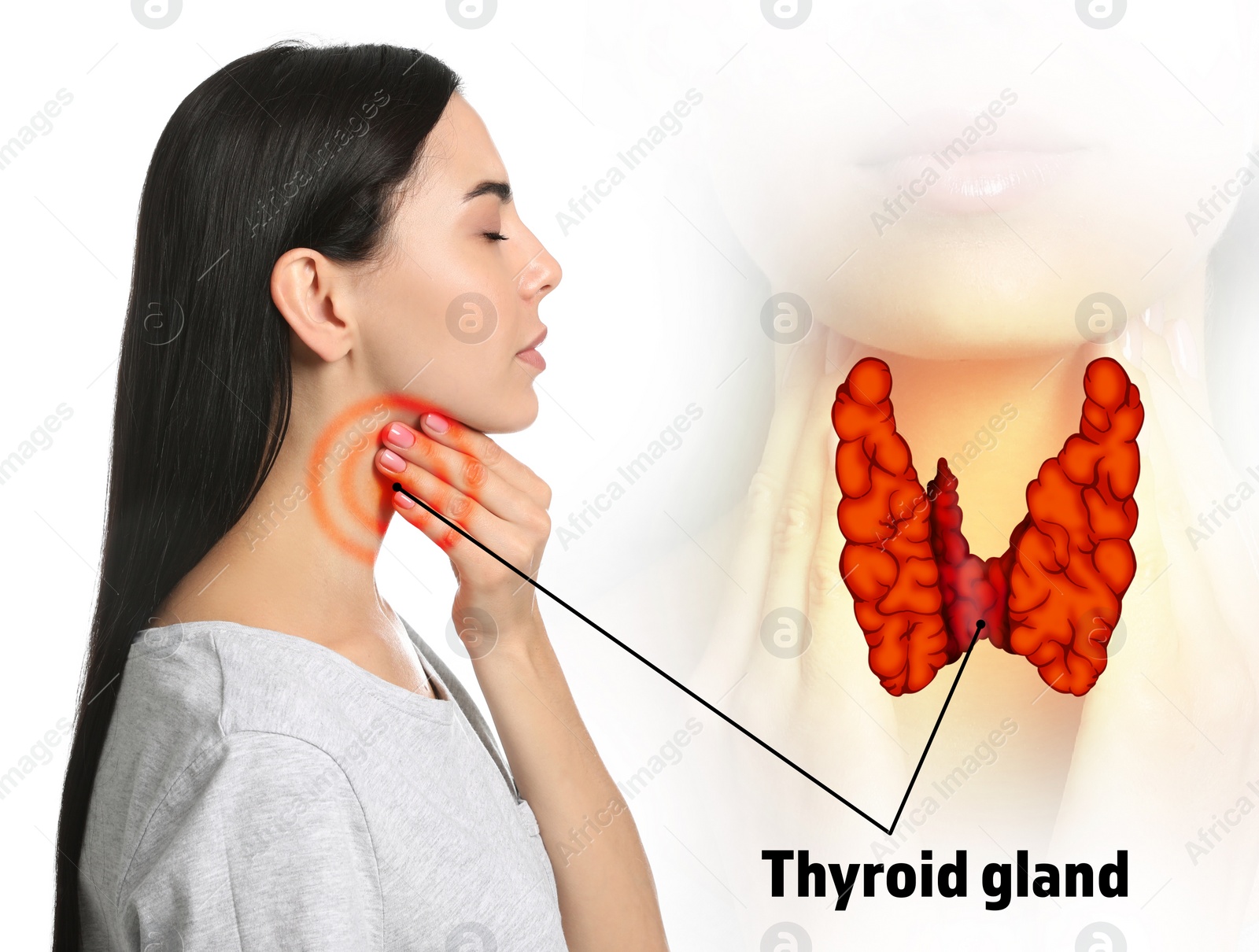 Image of Woman and illustration of thyroid gland on white background