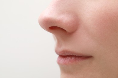 Photo of Woman with dry skin on white background, closeup of mouth