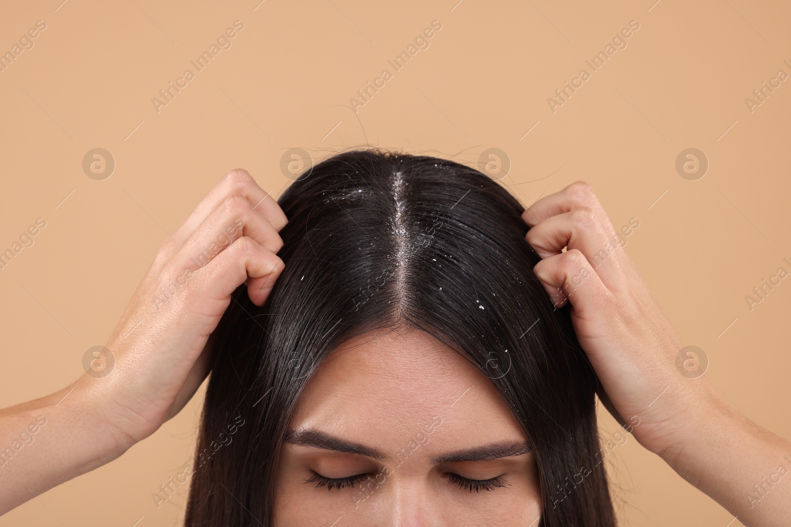 Photo of Woman examining her hair and scalp on beige background, closeup. Dandruff problem