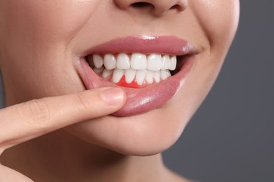 Young woman showing inflamed gums on grey background, closeup