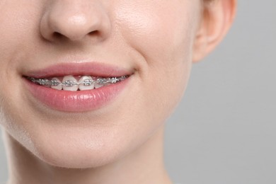 Smiling woman with dental braces on grey background, closeup