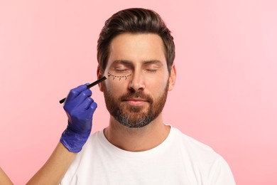 Image of Man preparing for cosmetic surgery, pink background. Doctor drawing markings on his face, closeup