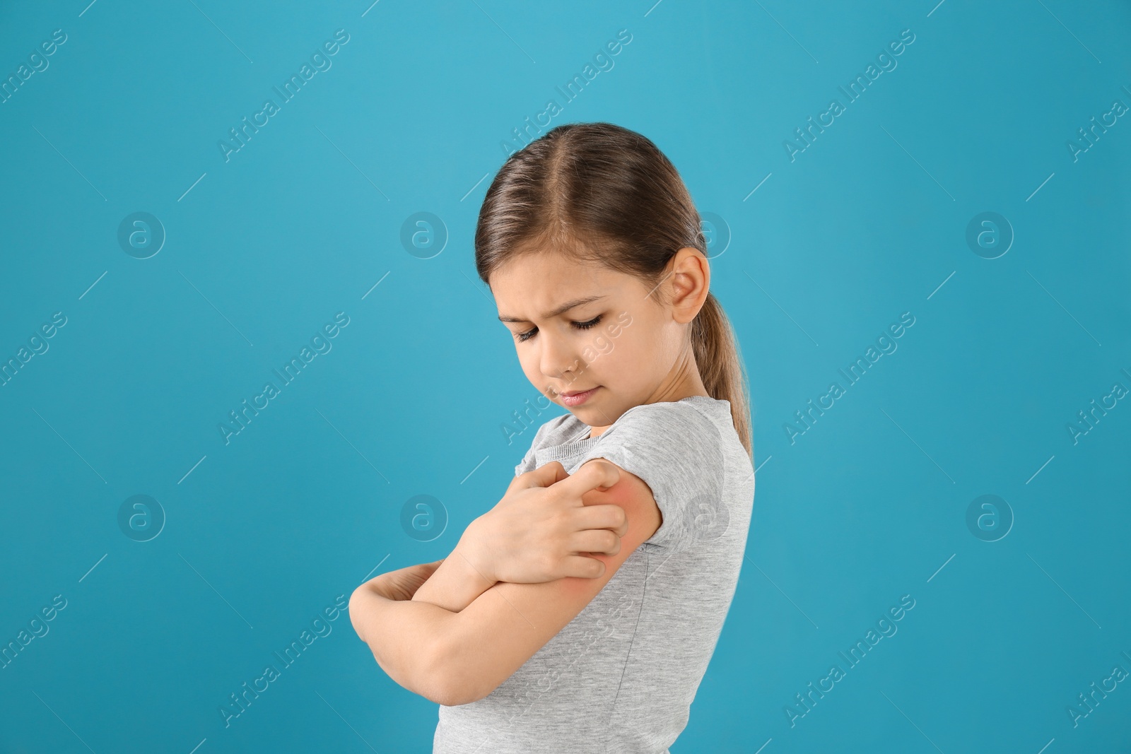 Photo of Little girl scratching arm on color background. Allergy symptoms