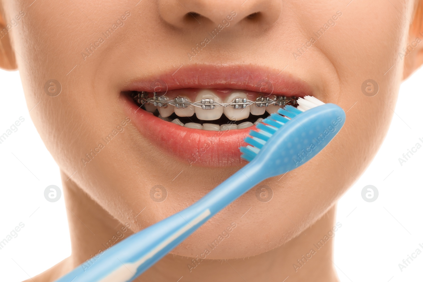 Photo of Woman with dental braces cleaning teeth on white background, closeup