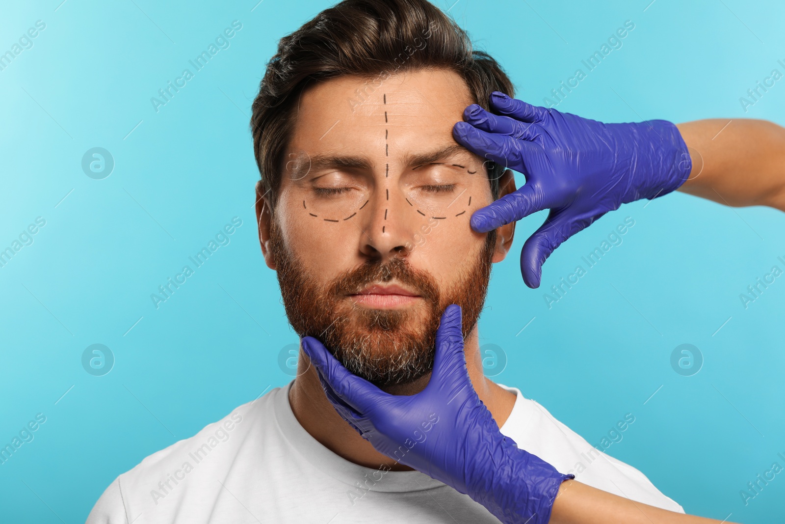 Photo of Doctor checking patient's face before cosmetic surgery operation on light blue background, closeup