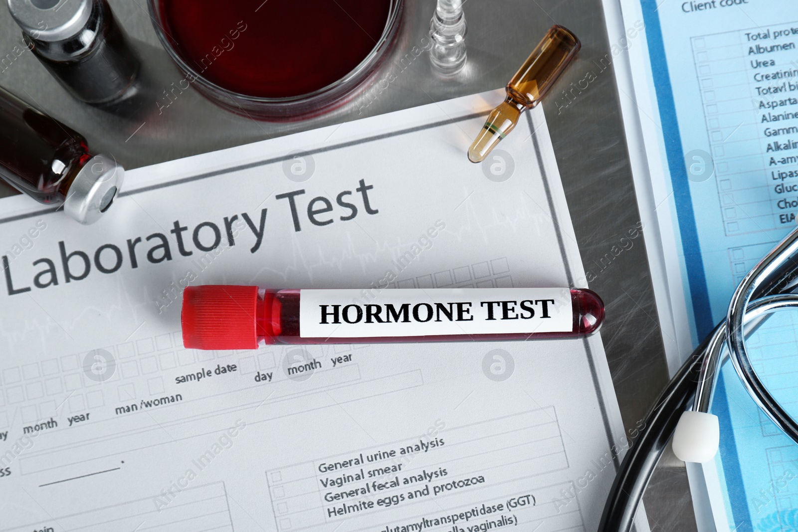 Photo of Glass tube with blood sample and label Hormone Test on metal table, flat lay