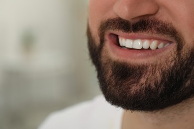 Photo of Happy young man with white teeth on blurred background, closeup