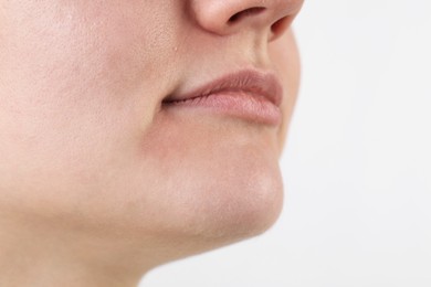 Photo of Woman with dry skin on white background, closeup view