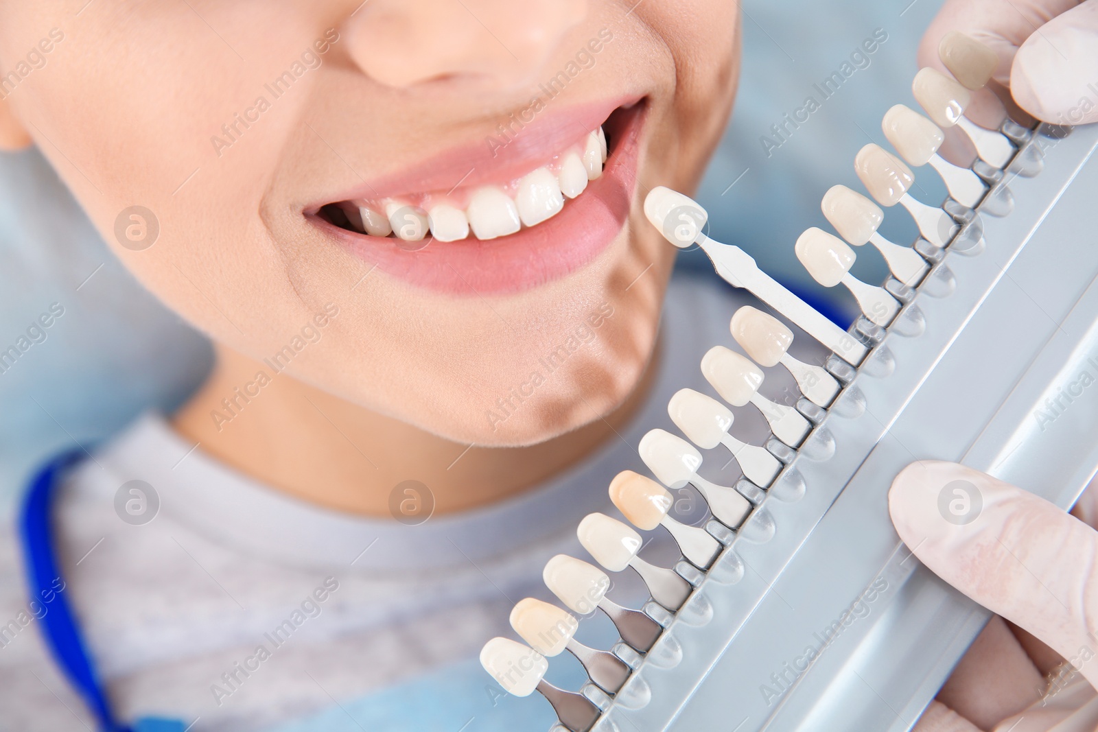 Photo of Dentist selecting patient's teeth color with palette in clinic, closeup