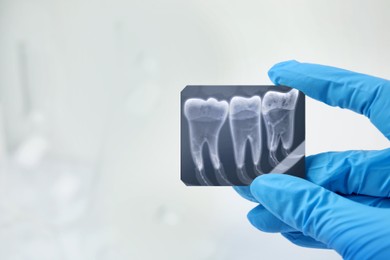 Image of Doctor holding x-ray picture of teeth indoor