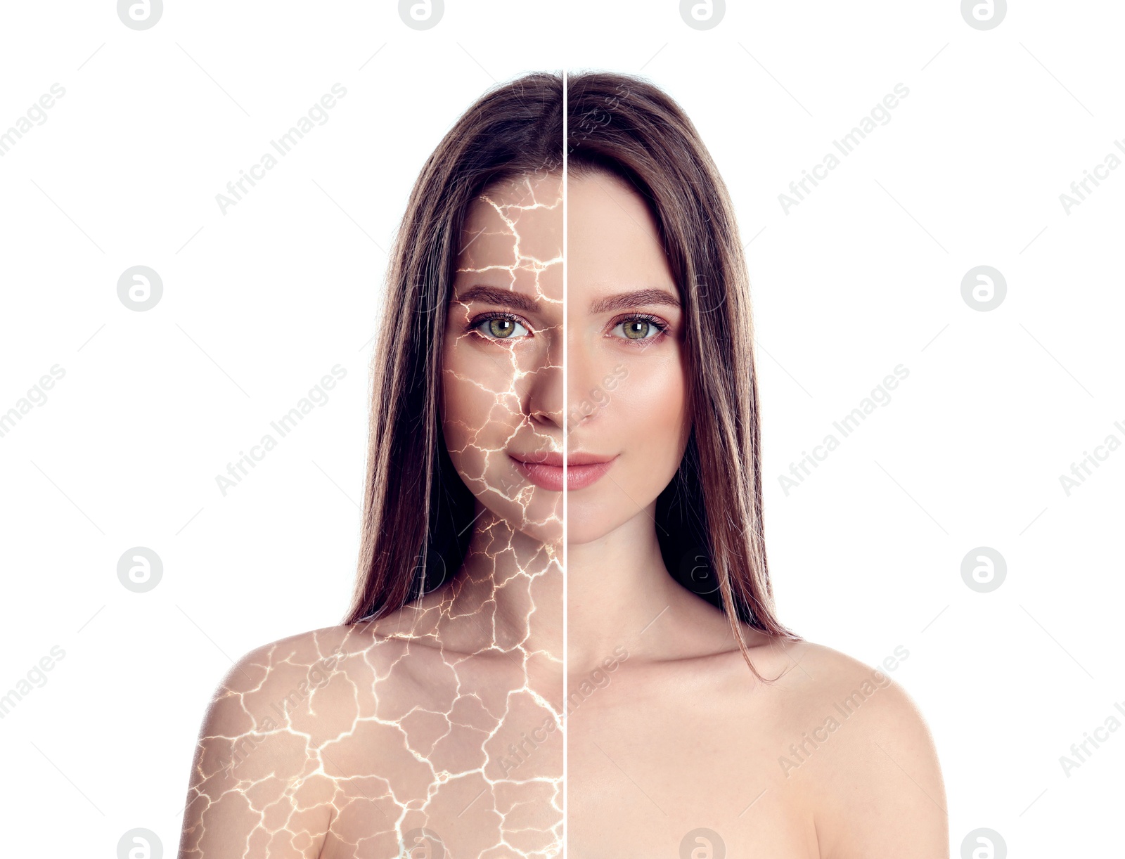 Image of Collage with photos of woman having dry skin problem before and after dry skin problem on white background