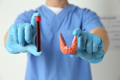 Photo of Endocrinologist showing thyroid gland model and blood sample in hospital, closeup