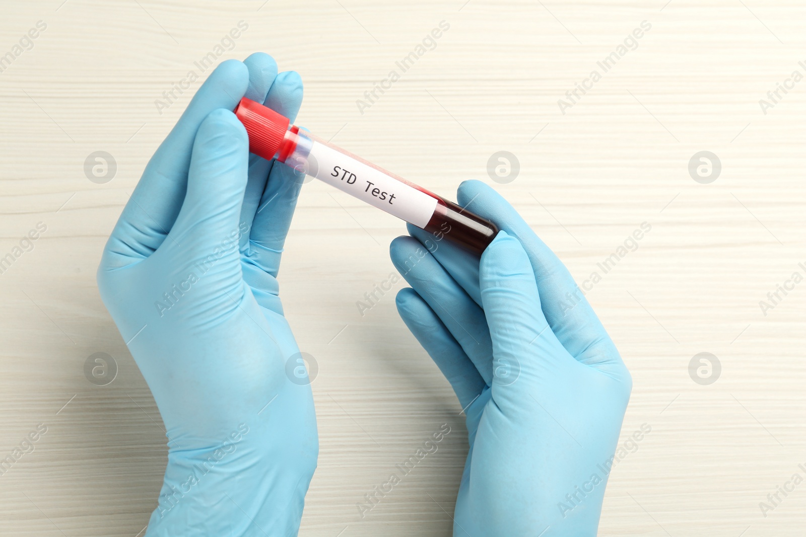 Photo of Scientist holding tube with blood sample and label STD Test at white table, top view