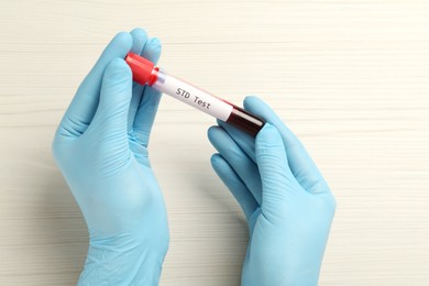 Photo of Scientist holding tube with blood sample and label STD Test at white table, top view