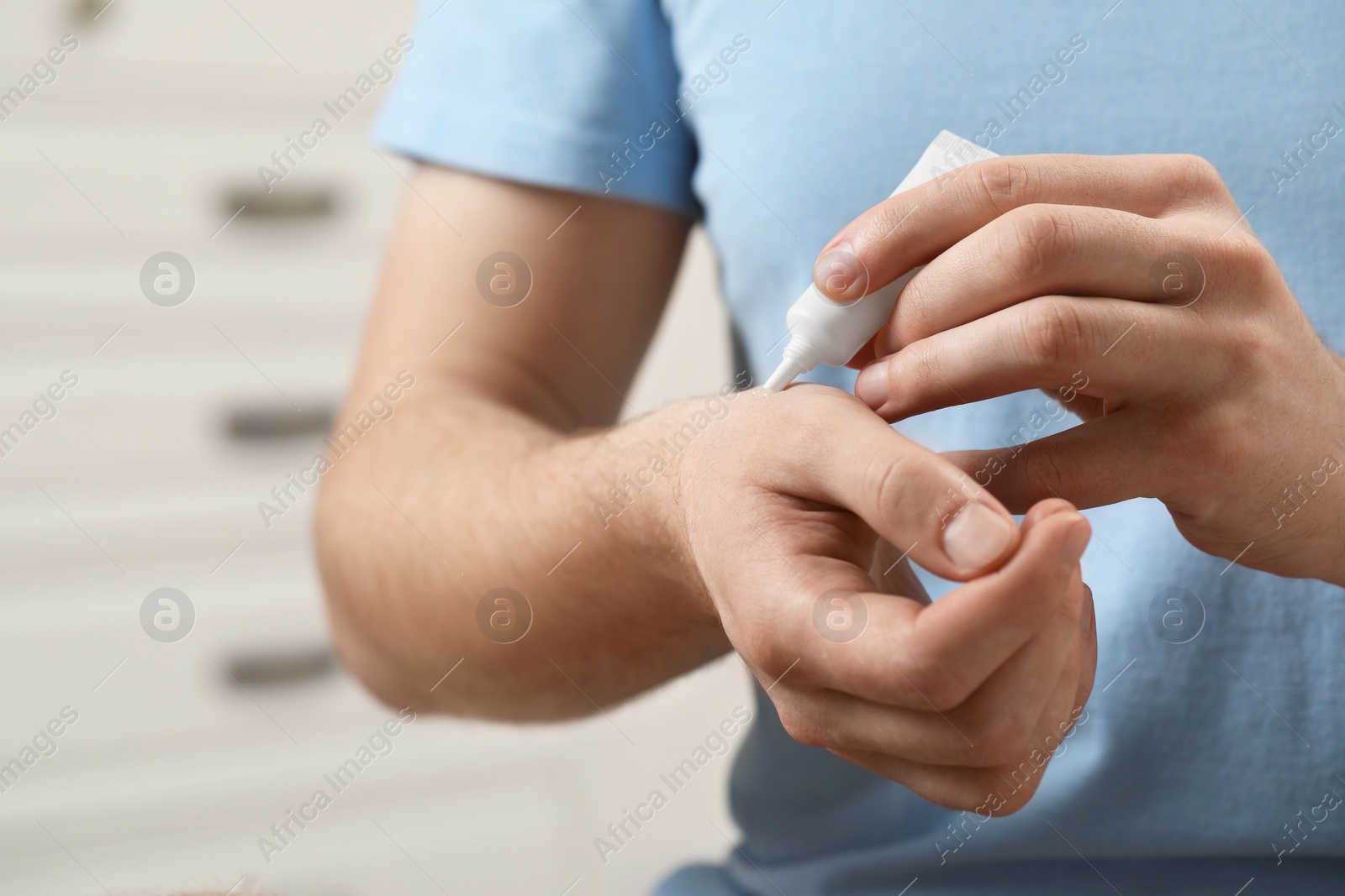 Photo of Man applying ointment from tube onto his wrist indoors, closeup