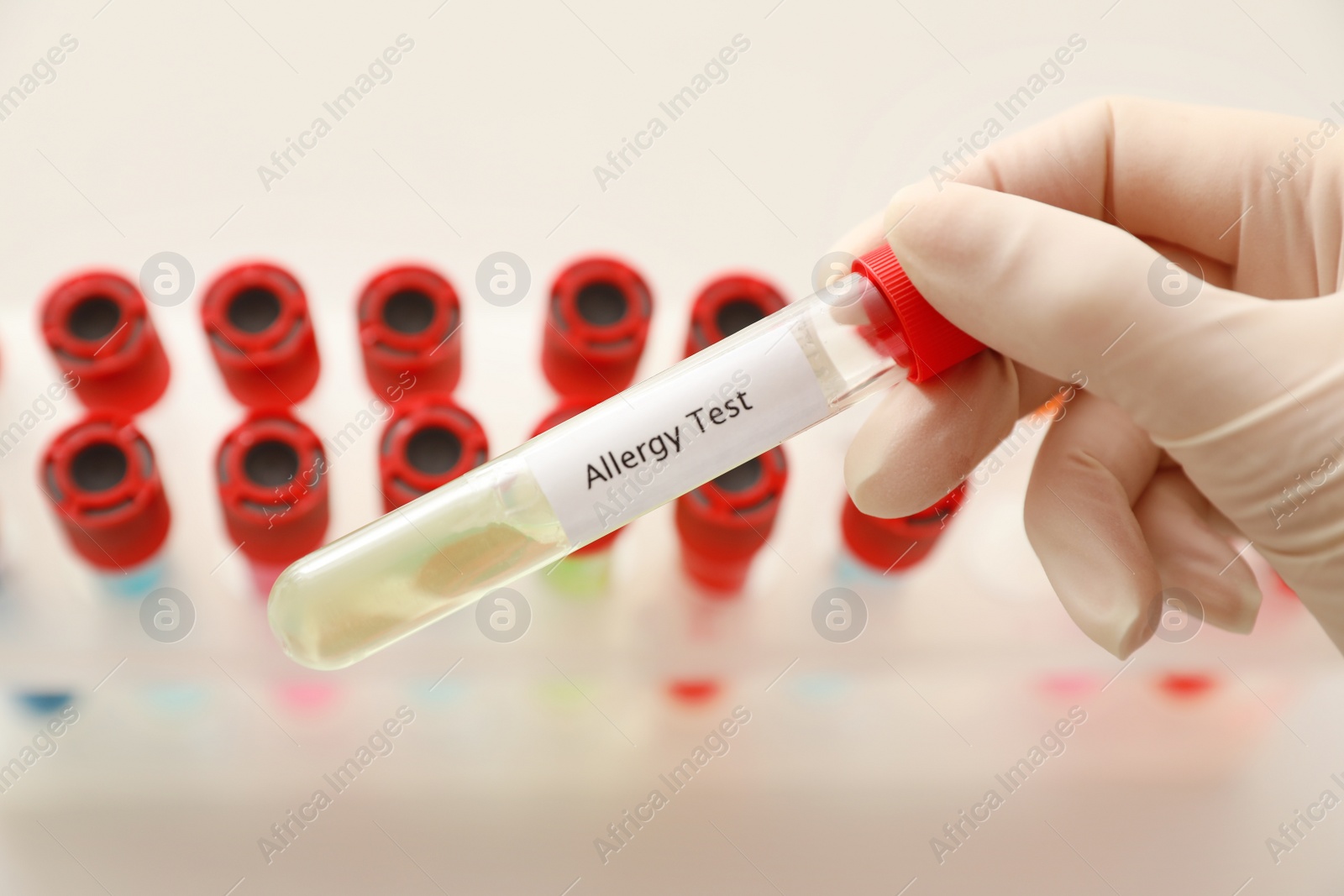 Photo of Doctor holding tube with label ALLERGY TEST over table, closeup