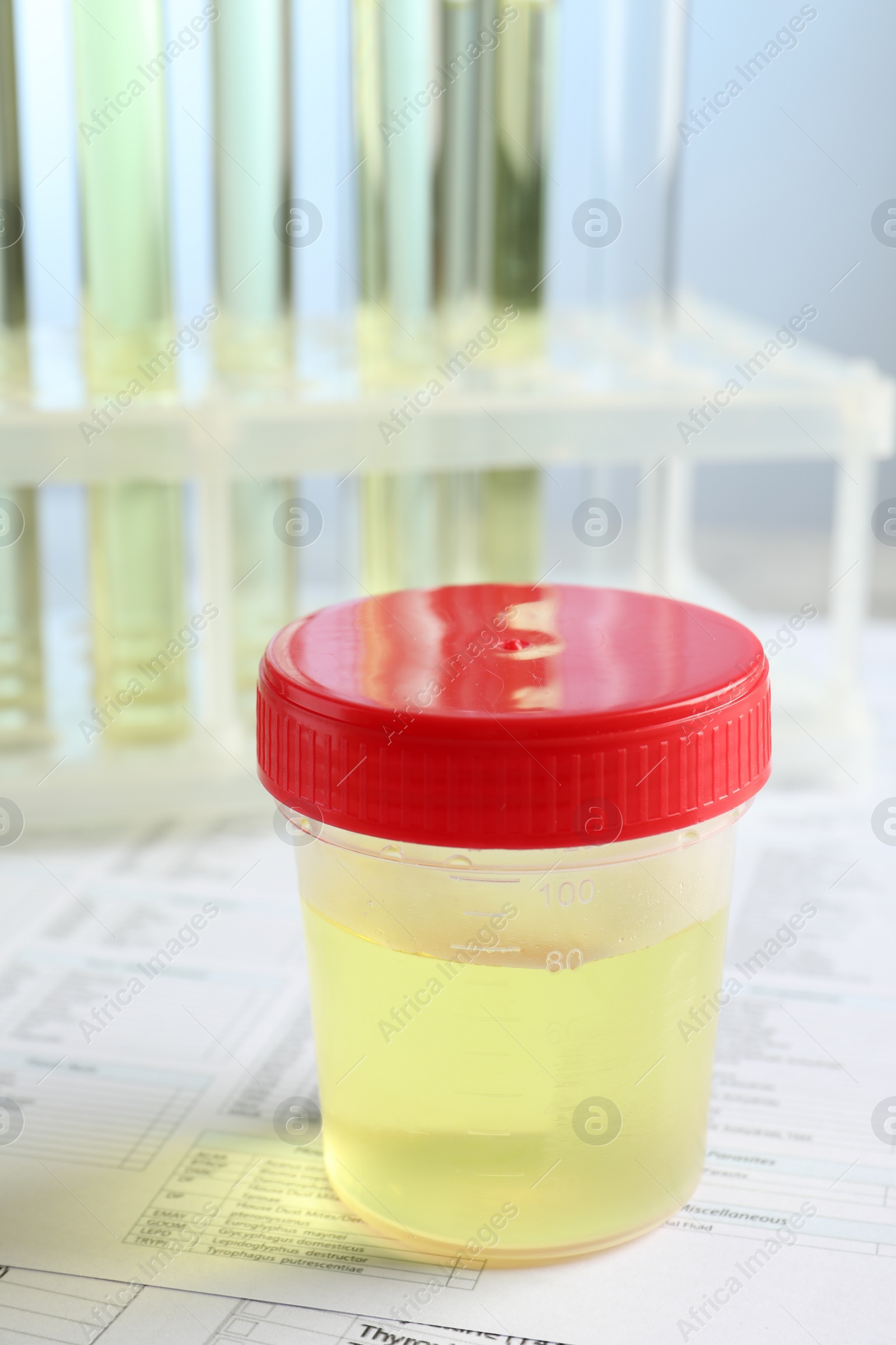 Photo of Container with urine sample for analysis on test forms in laboratory