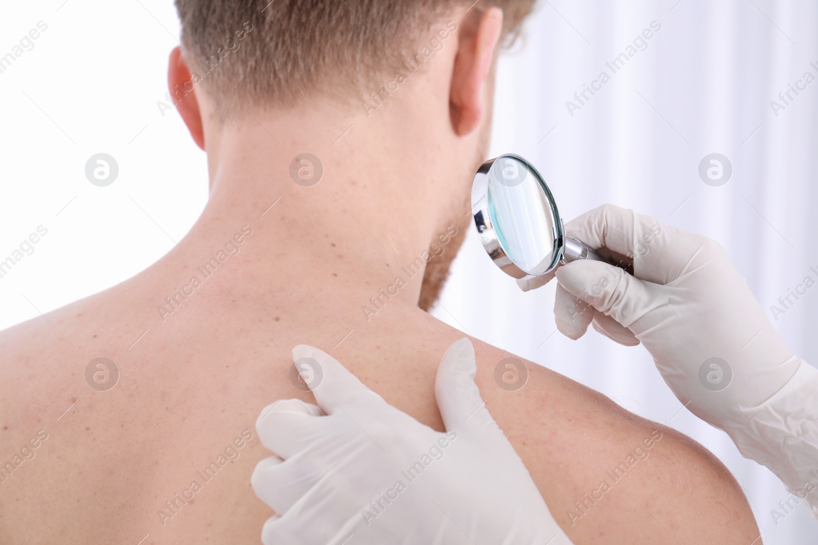 Photo of Dermatologist examining patient with magnifying glass in clinic, closeup view