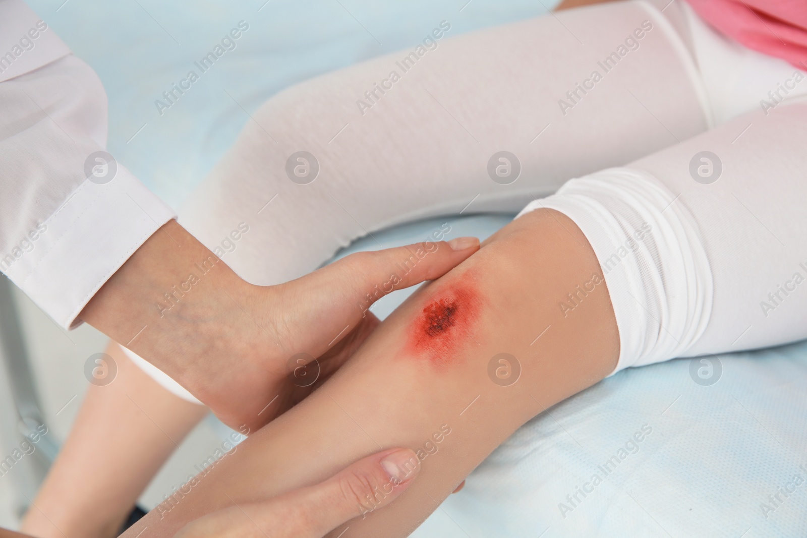 Photo of Female doctor examining little girl's injured leg in clinic, closeup. First aid