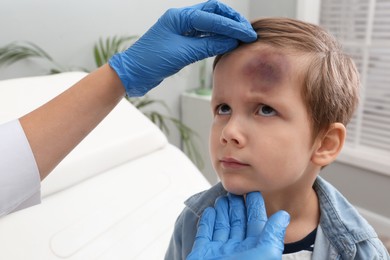 Photo of Doctor checking boy's forehead with bruise at hospital, closeup