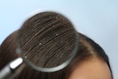 Photo of Closeup of woman with dandruff in her hair on color background, view through magnifying glass