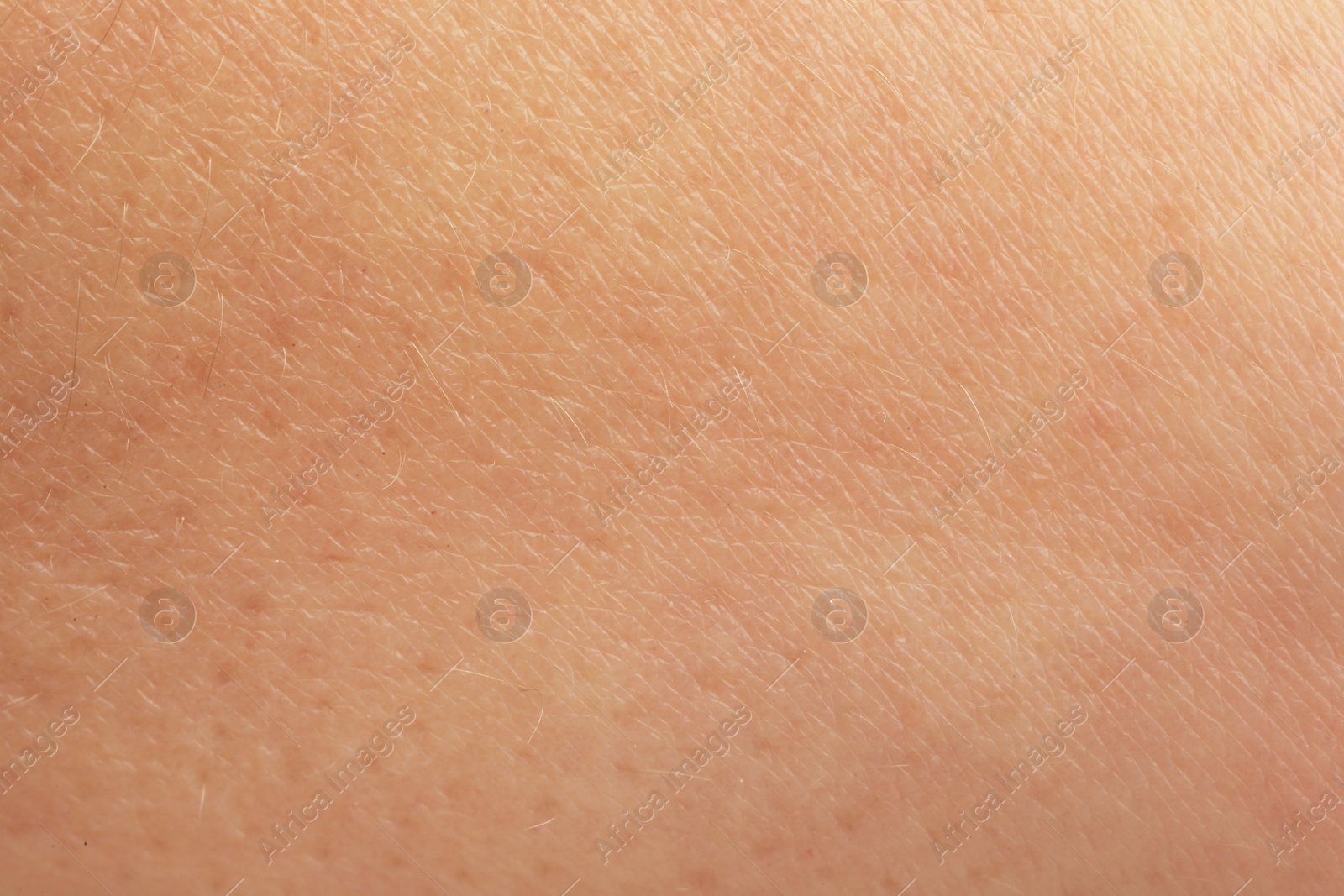 Photo of Texture of dry skin as background, macro view