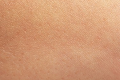 Photo of Texture of dry skin as background, macro view