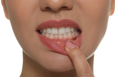 Young woman showing white teeth, closeup view