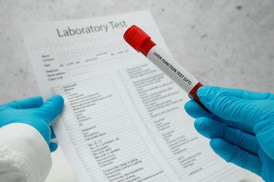 Photo of Liver Function Test. Laboratory worker holding tube with blood sample and form against blurred background, closeup