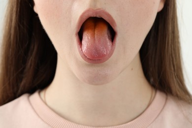 Photo of Gastrointestinal diseases. Woman showing her yellow tongue, closeup