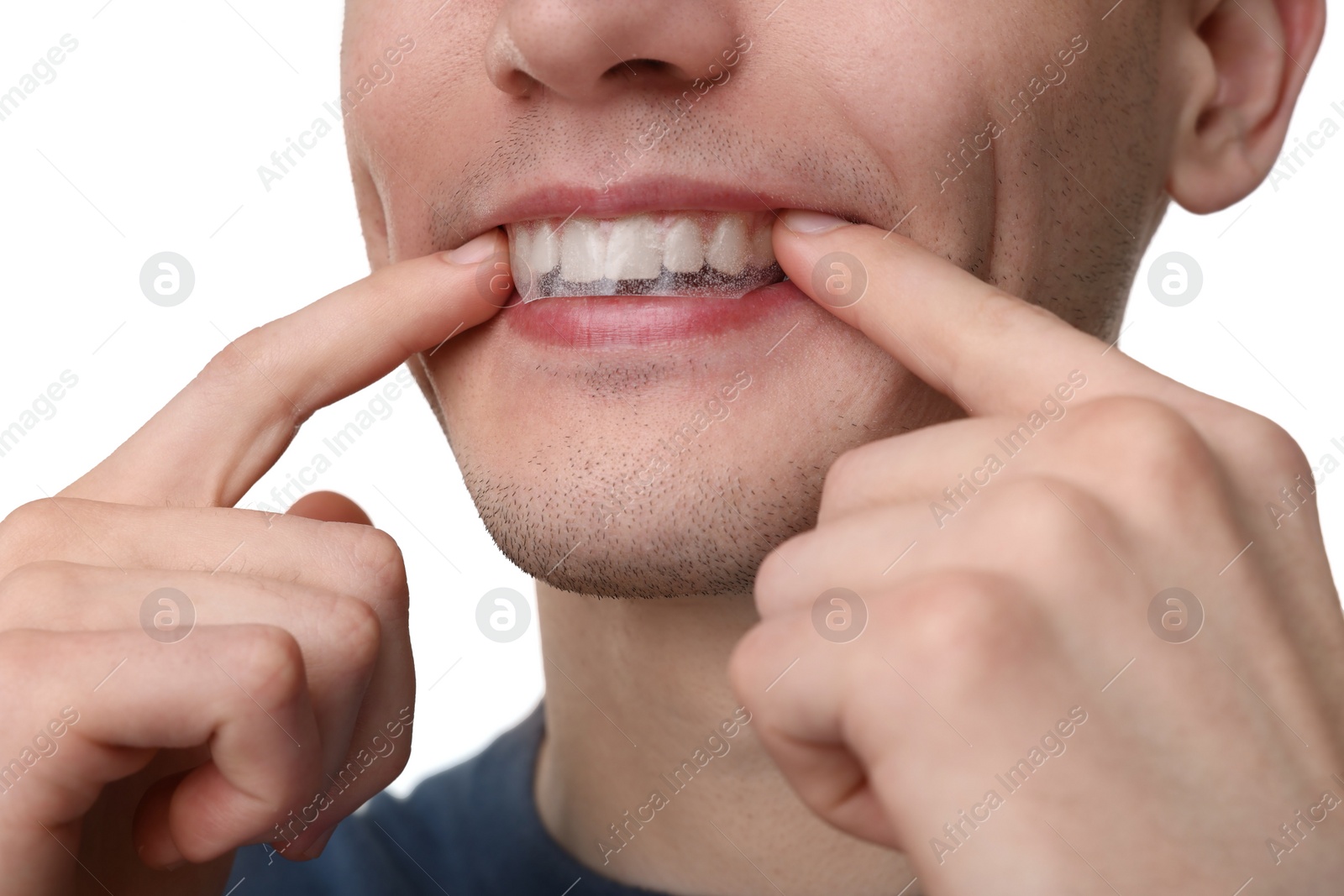 Photo of Young man applying whitening strip on his teeth against light background, closeup