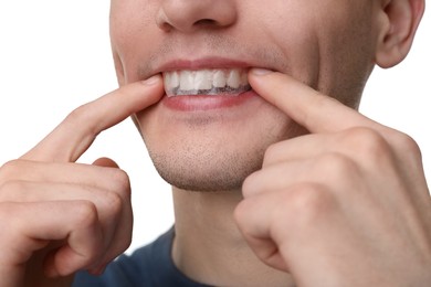 Young man applying whitening strip on his teeth against light background, closeup