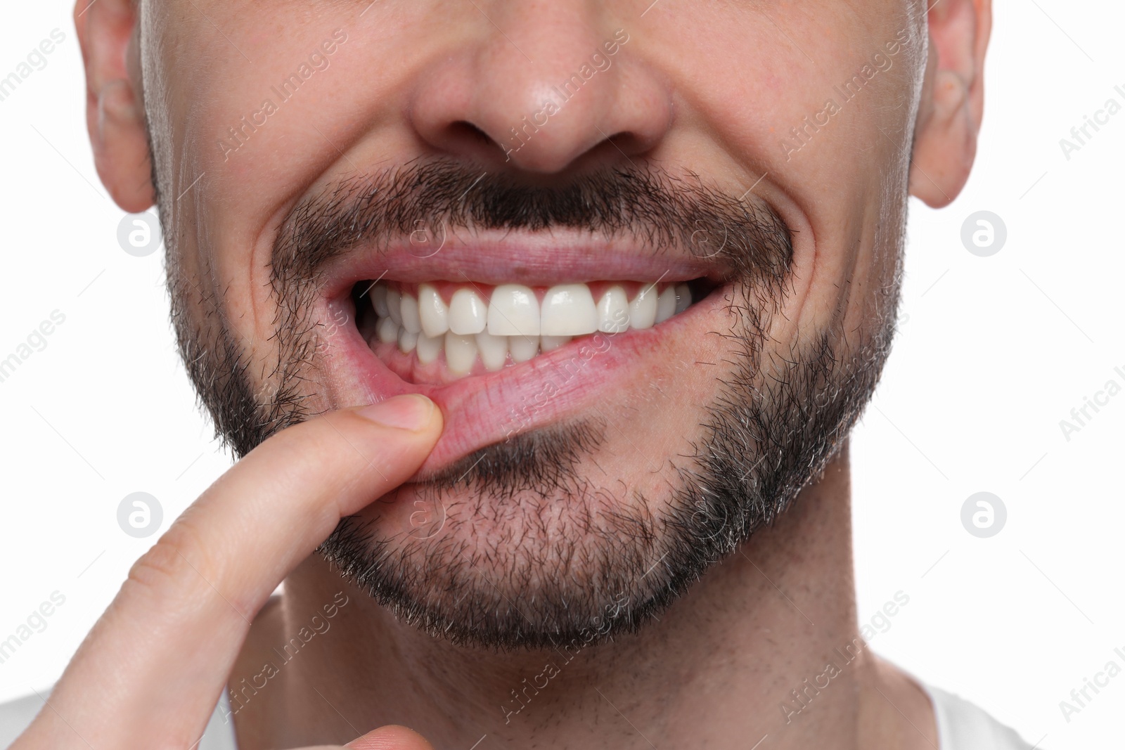 Photo of Man showing healthy gums on white background, closeup