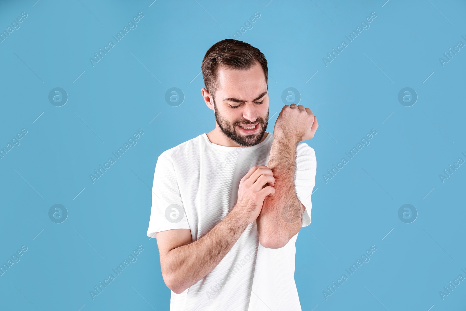 Photo of Young man scratching hand on color background. Allergies symptoms