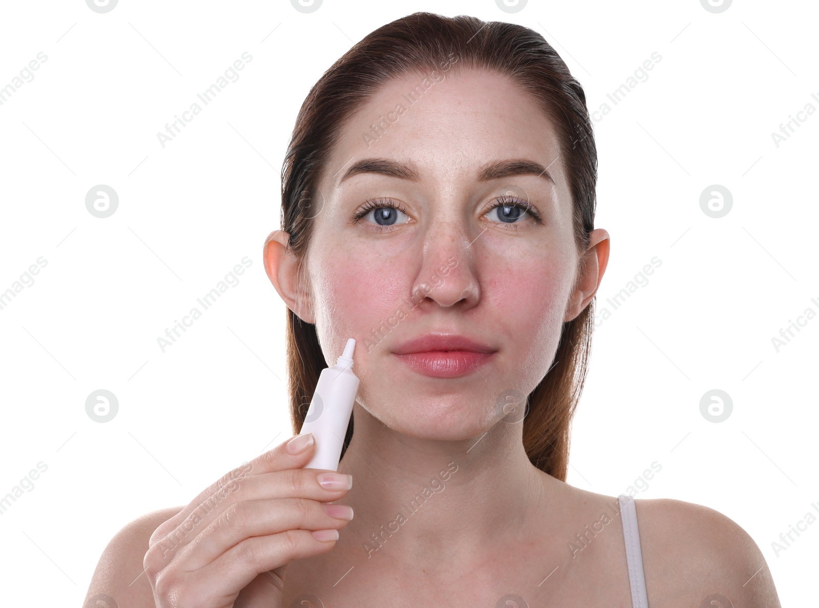 Photo of Young woman with acne problem applying cosmetic product onto her skin on white background