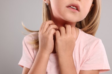 Photo of Suffering from allergy. Little girl scratching her neck on light gray background, closeup