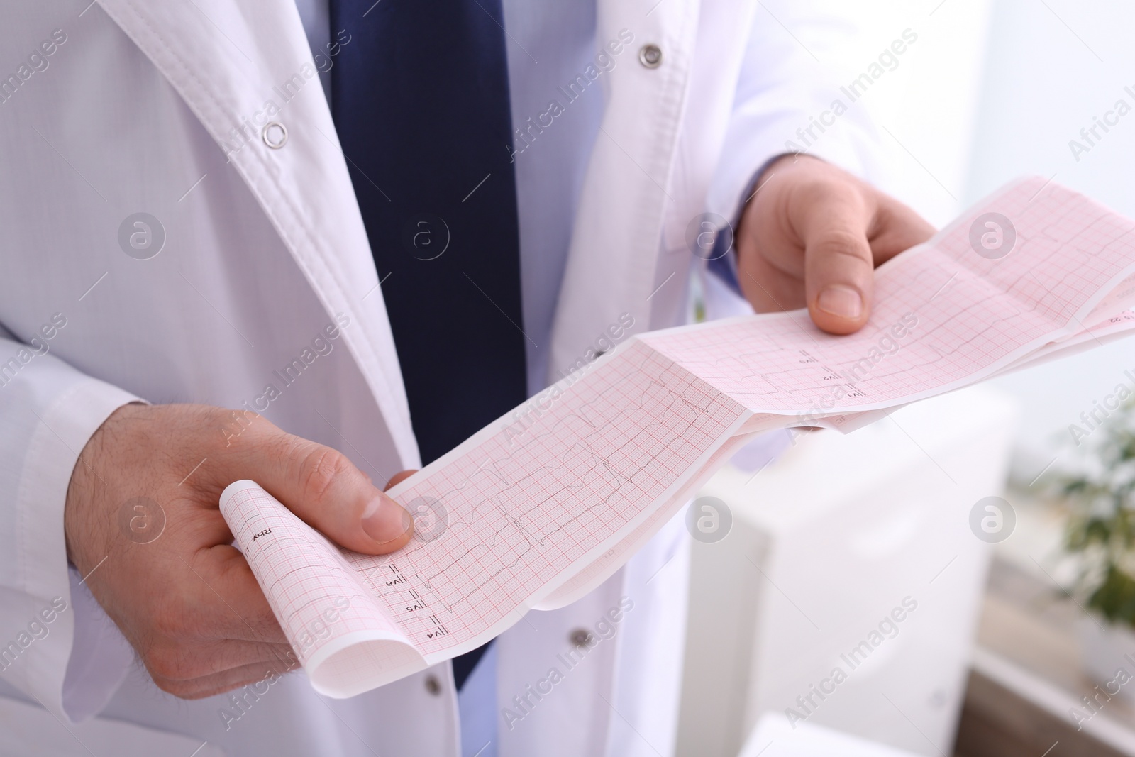 Photo of Doctor examining cardiogram in medical clinic, closeup