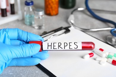 Photo of Doctor in glove holding test tube with word Herpes near different pills and clipboard on light grey table, closeup