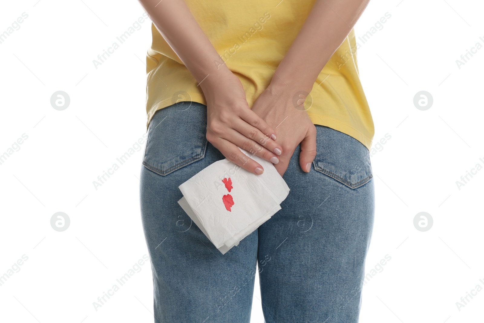 Photo of Woman holding toilet paper with blood stain on white background, closeup. Hemorrhoid concept