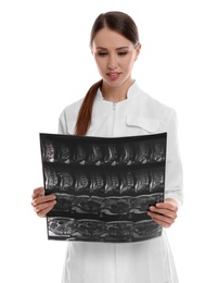 Photo of Orthopedist holding X-ray picture on white background