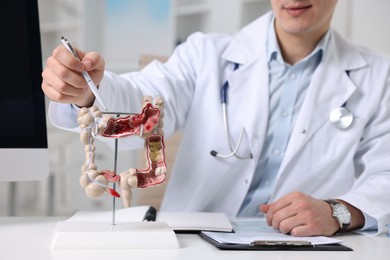 Photo of Gastroenterologist showing anatomical model of large intestine at table in clinic, selective focus